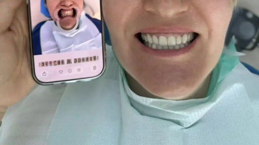Пациентка клиники Ченгши Дентал после лечения — новая улыбка
